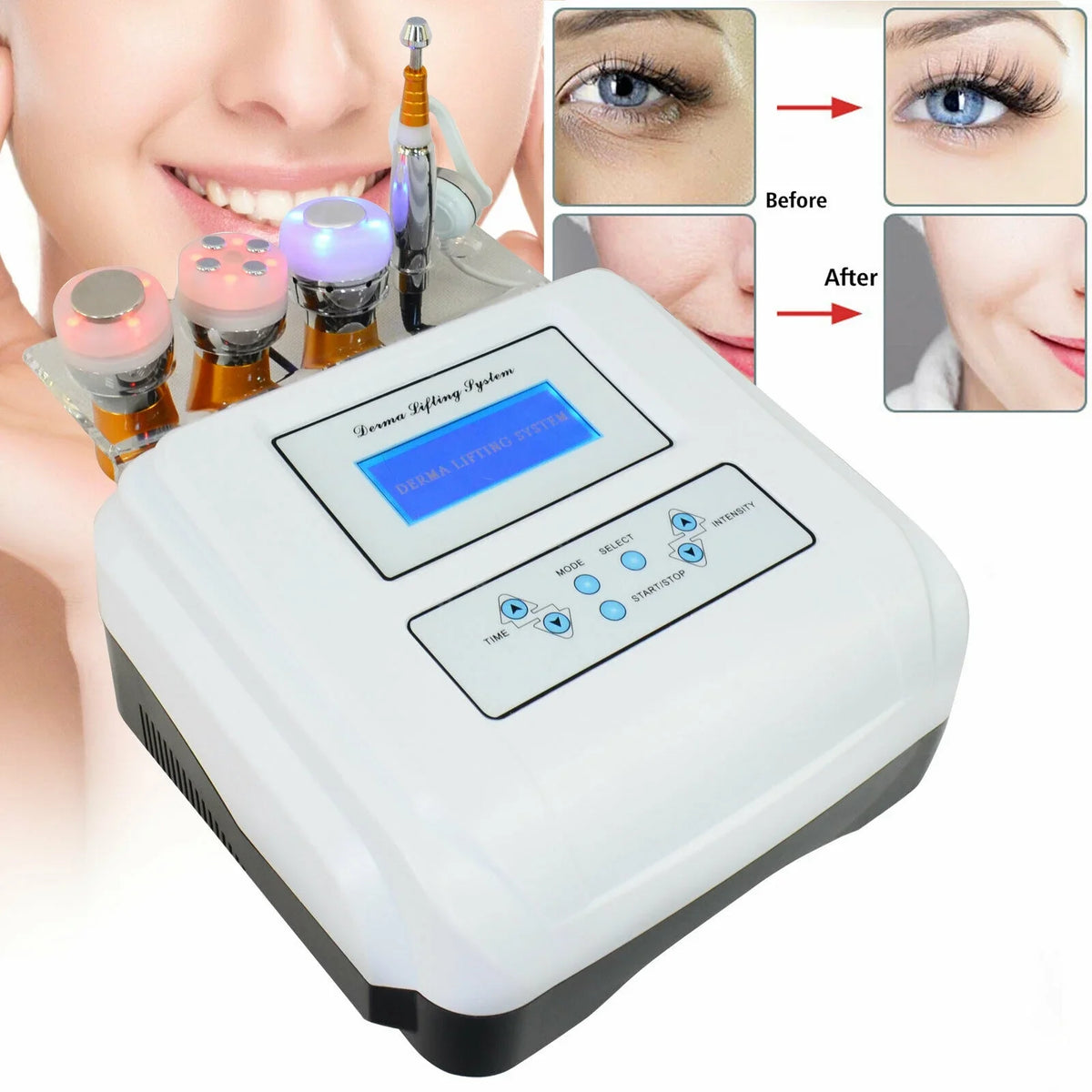Electroporation Lift Needle TFCFL Cryo Machine Removal No Wrinkle Spa Mesotherapy Skin