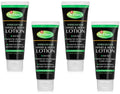 Hydrocortisone 4 and Hand Dr. 2.5 Anti Dans Pack Each oz Lotion Itch Body