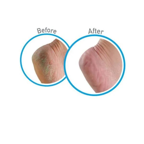Healthy Feet 3oz. Cream (5-Pack) Foot