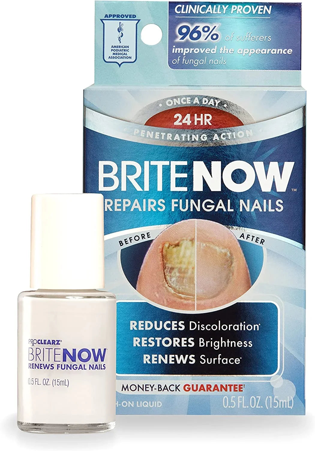 Nail Nail Peel-Away Treatment, Technology, Damaged The Repair, Now Smoothing Ounce Restores ProClearz Discolored Of & Nails, Brightening & Appearance Brite 0.5