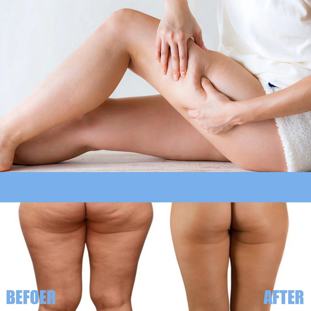 Thigh Sculpting Collagen Patch Eelhoe Thigh Lazy Tape, Lift Essence Tightening Patch,